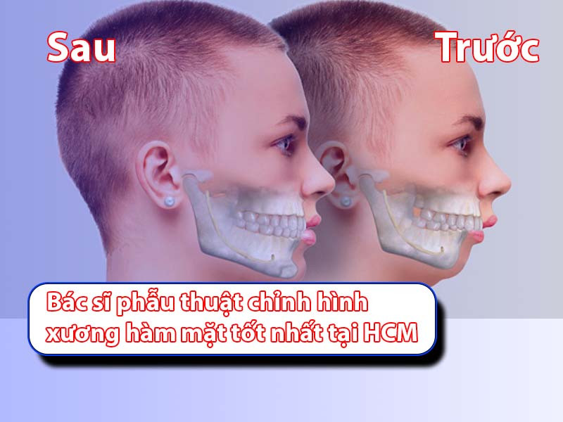 Bác sĩ phẫu thuật chỉnh hình xương hàm mặt tốt nhất tại HCM